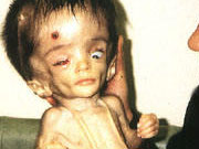 Depleted Uranium